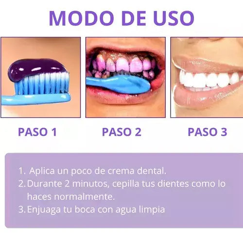 Blanqueamiento dental Smilekit V34